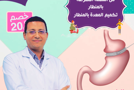 عمليات تكميم المعدة بالمنظار
