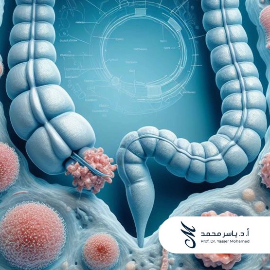 Prof. Dr. Yasser Mohamed - Anal Cancer Poster