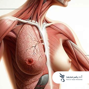 Prof. Dr. Yasser Mohamed - Breast Cancer Poster