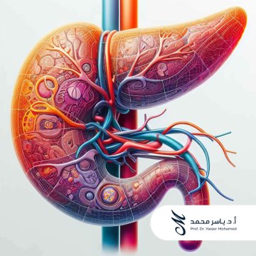 Prof. Dr. Yasser Mohamed - Pancreatic Cancer Poster