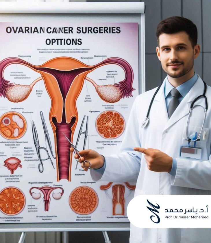Prof. Dr. Yasser Mohamed - What are the Types of Ovarian Cancer Surgeries
