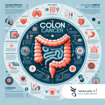 Prof. Dr. Yasser Mohamed - What is Colon Cancer